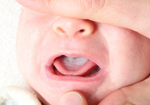 7 nguyên nhân trẻ sơ sinh biếng bú giúp mẹ xử lý đúng cách 2